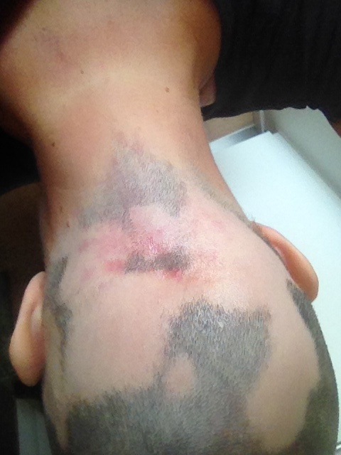 Nakken, som den stadig ser ud idag. Bare med lidt længere hår.